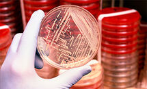 Antimicrobial-resistance_H Thumbnail